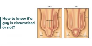 How-to-know-if-a-guy-is-circumcised-or-not