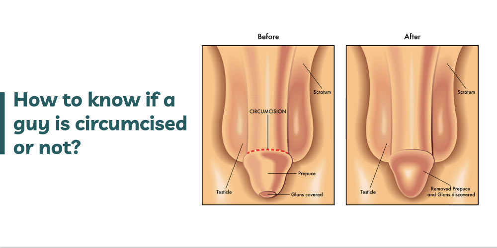 How to know if a guy is circumcised or not?